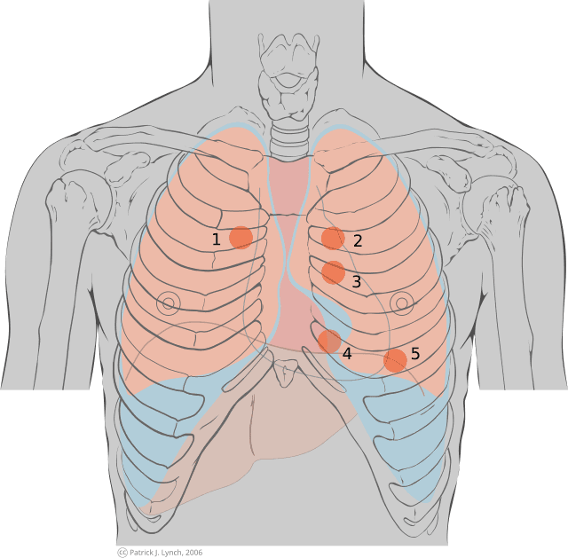 Question illustration for Q1